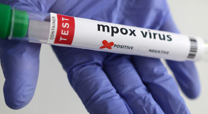 India Reports First Mpox Clade 1b Case In Kerala: Report - BW Businessworld