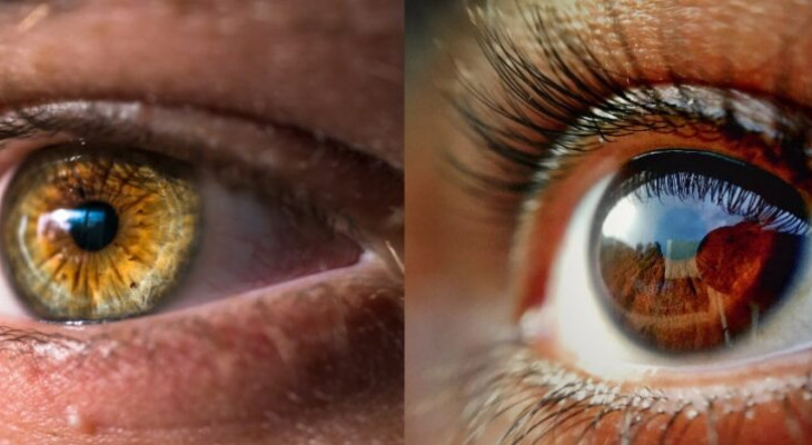 Late Glaucoma Diagnosis Threatens Vision in Urban India